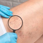 Vehicle Crashes into Crowd in East Hollywood, Los Angeles, Injuring 31 Amid Gunfire